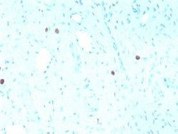 HPV16 Antibody (rHPV16L1/1058) - Azide and BSA Free, Novus Biologicals